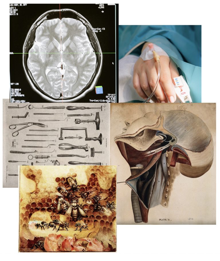 Five images laid out together as a mood board. A scan of a brain, a photo of someone's hand in hospital with a cannula in, a vintage illustration of surgical tools, a vintage anatomical illustration of a neck and head and a vintage illustration of wasps in a hive.